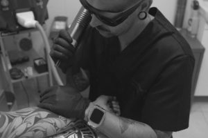 Tratamiento láser PicoSure